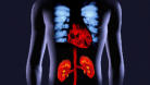 m14_005 Arterieller Gef��verlauf der Herz- und Nierenarterien