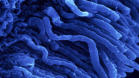 m20_009 Detailaufnahme von Sehnervengruppe (Retina)