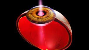 m04_007 Auge in der Perspektivansicht mit Hornhaut, Iris und Linsenk�rper