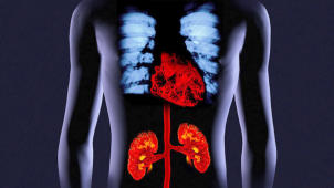 m14_005 Arterieller Gef��verlauf der Herz- und Nierenarterien