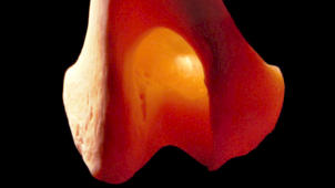 m01_029 Oberschenkelknochen (Femur) in der Kniegelenksregion