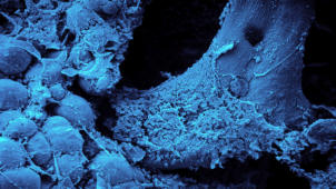 m01_015 Spongiosa-B�lkchen mit Fettzellen (REM-Aufnahme)