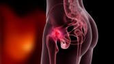 m01_039 Patientin mit Kox-Arthrose im linken H�ftgelenk